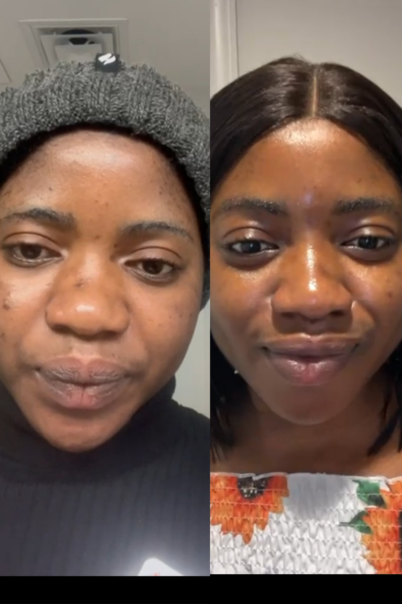 Dark Spots Fading Serum