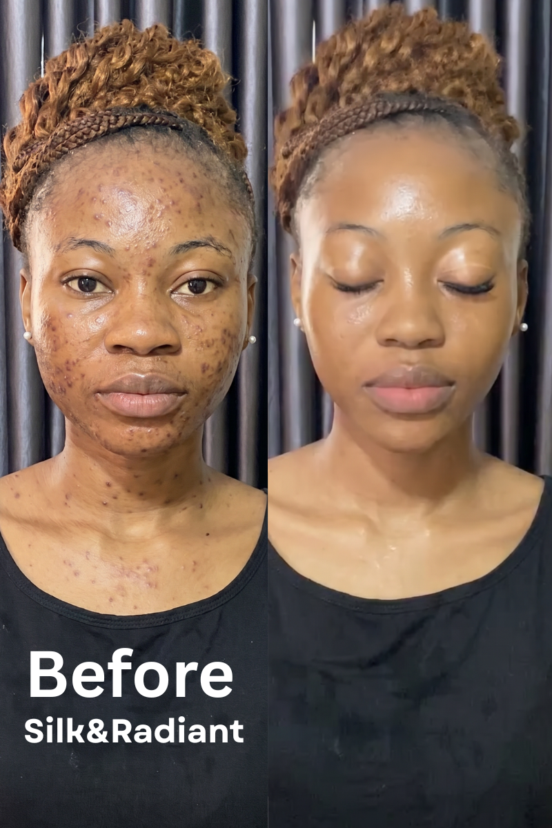 Dark Spots Fading Serum