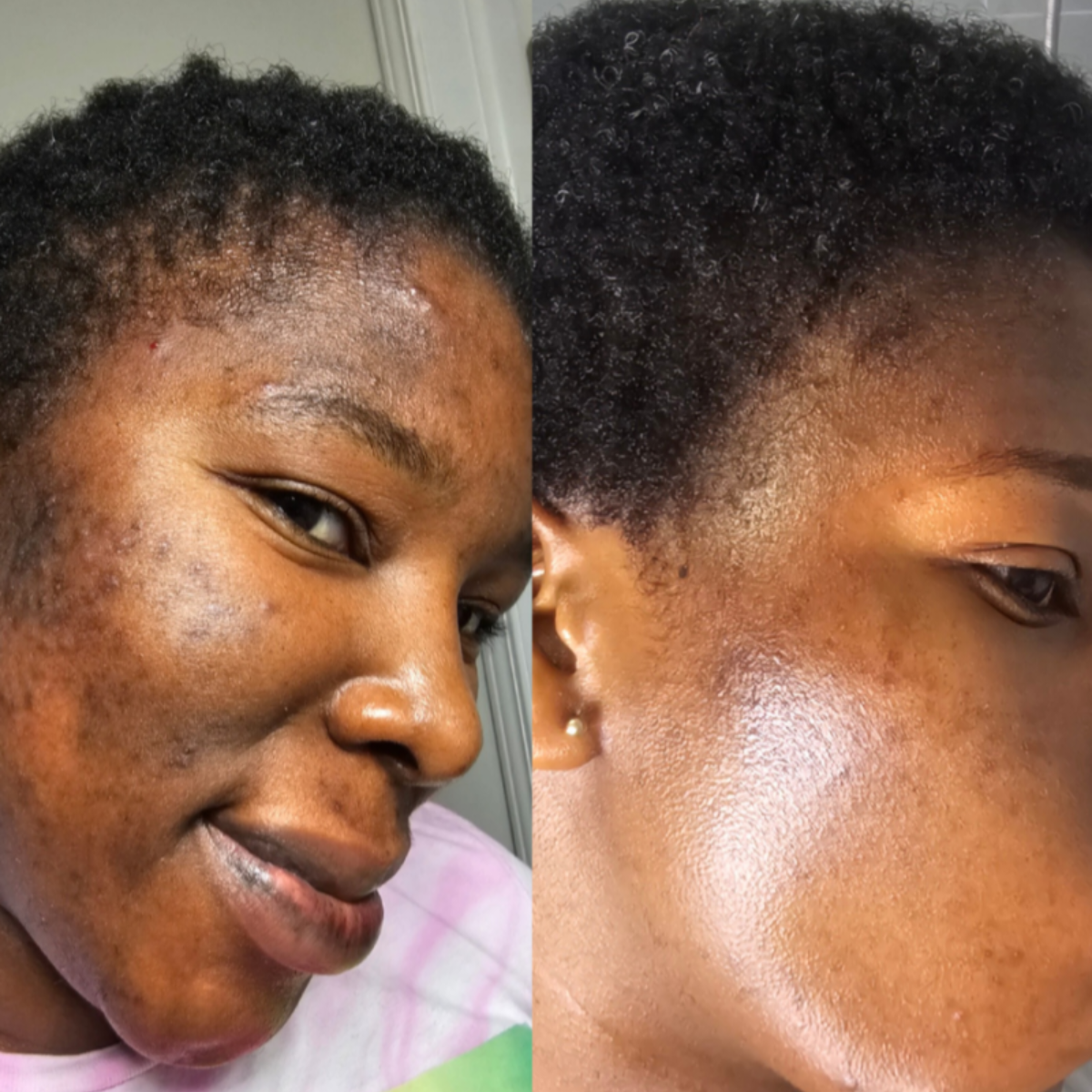 Radiance and Dark Spots Fading Face scrub