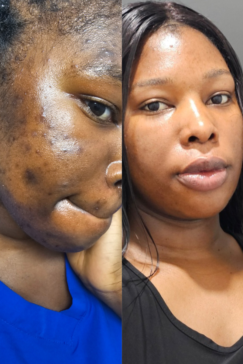 RADIANCE AND MOISTURE REPAIR BUTTER