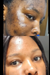 ULTIMATE ACNE COMBO SOLUTION