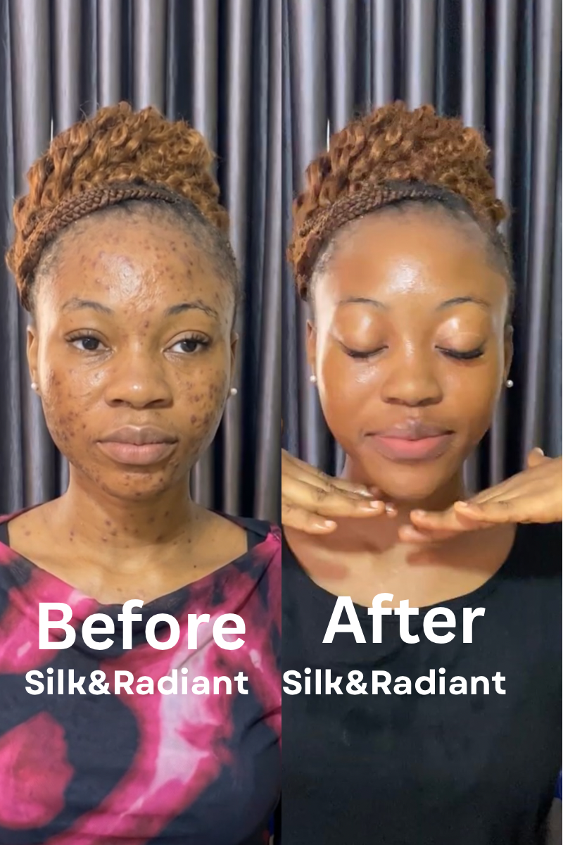 GLOW REBIRTH COMBO. FOR RADIANCE AND DARK SPOTS