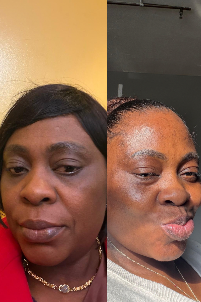 Dark Spots Fading Serum