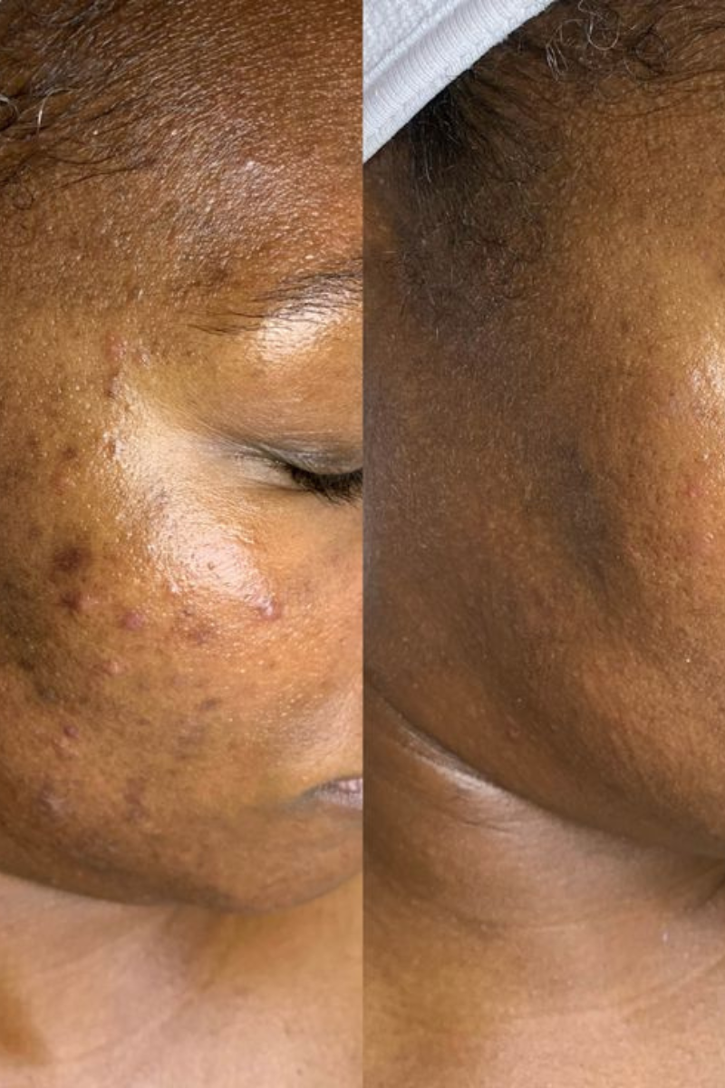 RADIANCE AND DARK SPOTS COMBO